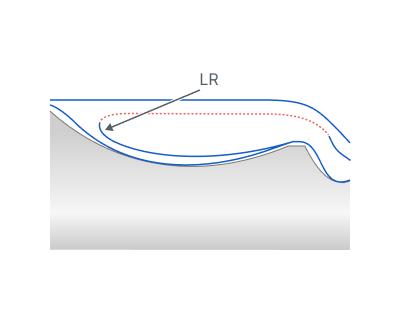 images/download/attachments/147761892/Linkining_radius.png