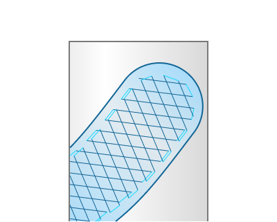 images/download/attachments/147763347/planar_Alternate_lines_direction_%28on%29.png