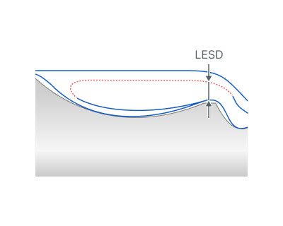 images/download/attachments/162973099/Lead_Safe_Distance.png