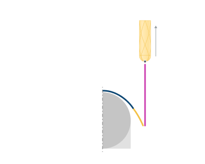 images/download/attachments/164707795/Retract_%28By_Tangentl%29.png