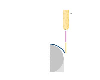 images/download/attachments/164707795/Retract_%28By_Vertical_Normal%29.png